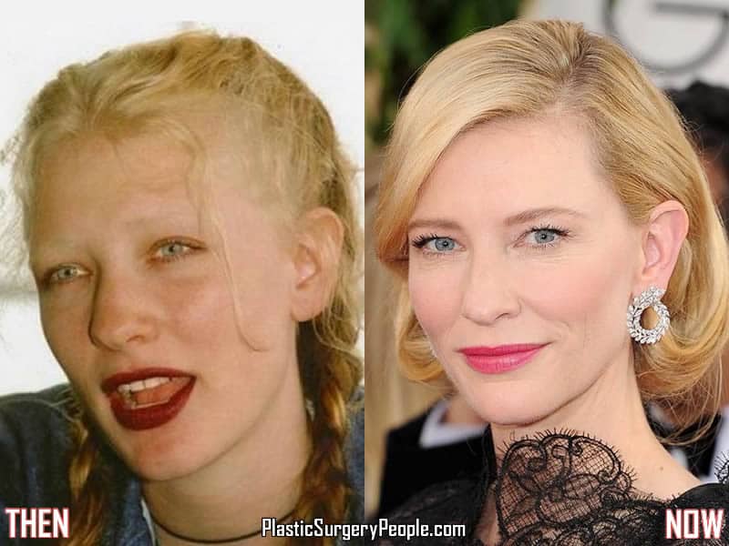 Cate Blanchett Before & After
