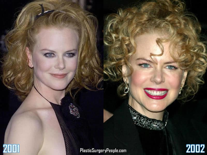 Nicole Kidman - 2001 to 2002
