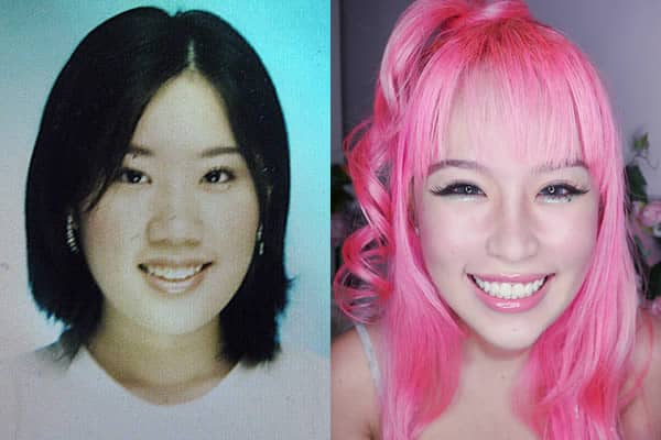 Xiaxue Plastic Surgery Before and After