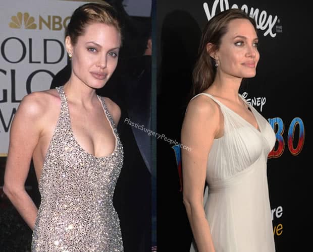 Angelina Jolie boob job before and after