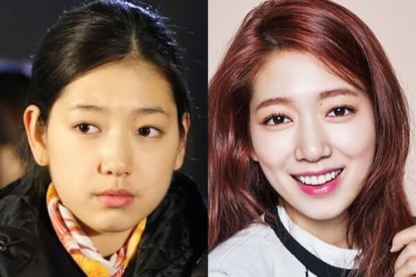 Park Shin Hye before and after plastic surgery?