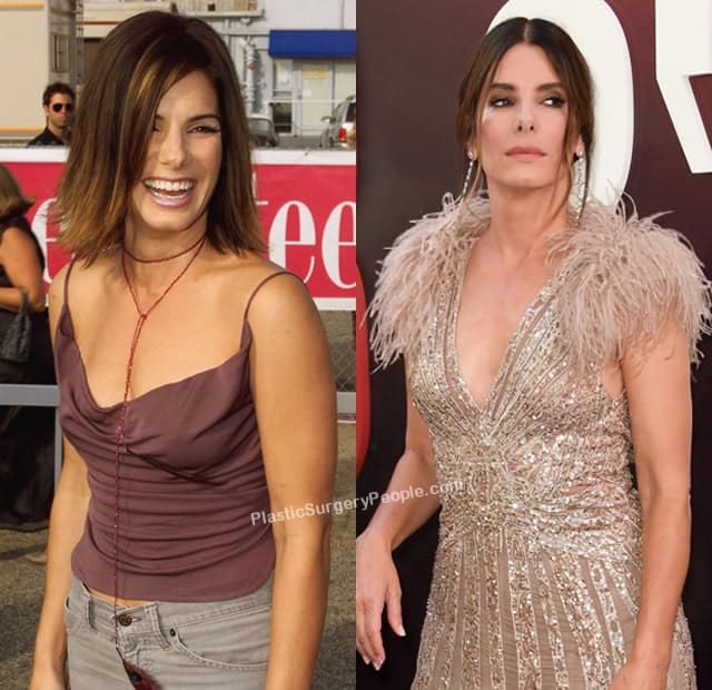 Did Sandra Bullock have a boob job?
