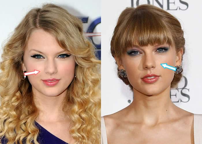 Has Taylor Swift Had a Nose Job?