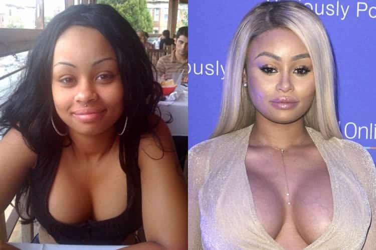 Blac Chyna boob job before and after photo