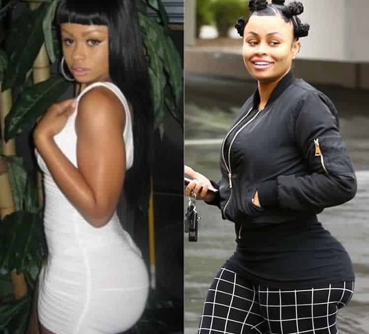Blac Chyna butt implants before and after photos