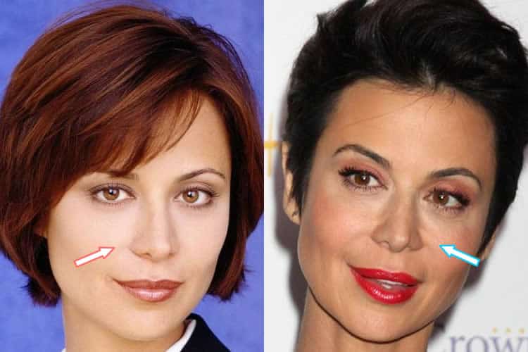 Has Catherine Bell Had Nose Job?