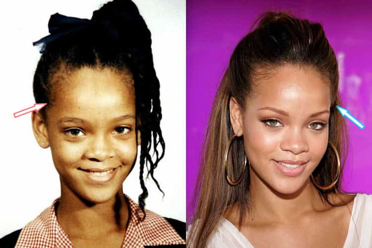 Rihanna's big forehead
