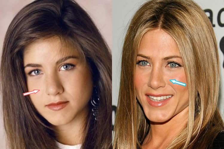 Did Jennifer Aniston Have A Nose Job?
