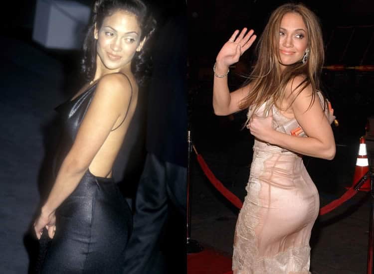Did Jennifer Lopez Have Butt Implants?