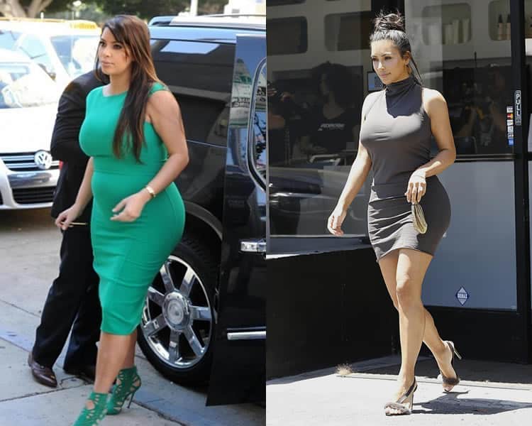 Did Kim K Get Liposuction For Weight Loss?