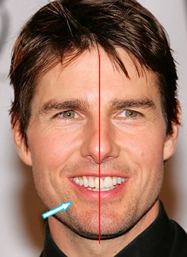 Tom Cruise's Front Teeth Alignment