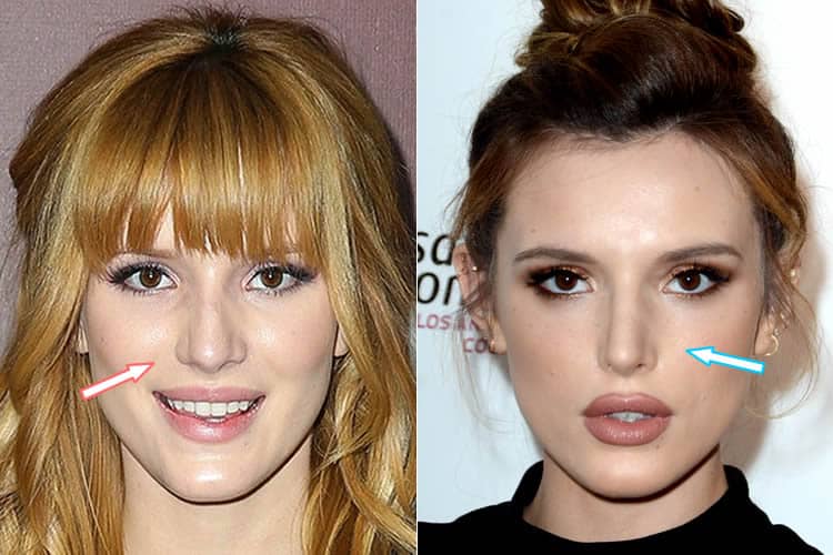 Bella Thorne nose job before and after photo