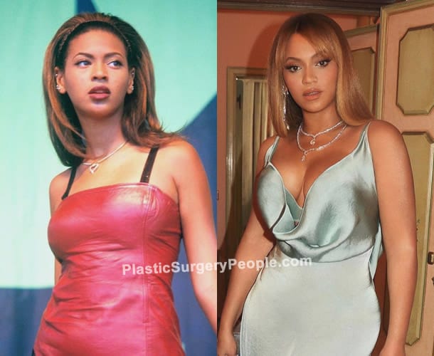 Beyonce boob job before and after photo