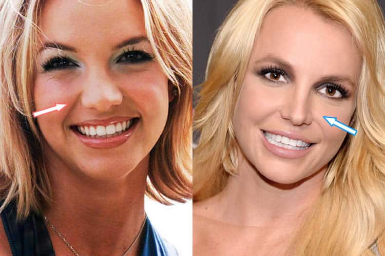 Has Britney Spears Had A Nose Job?