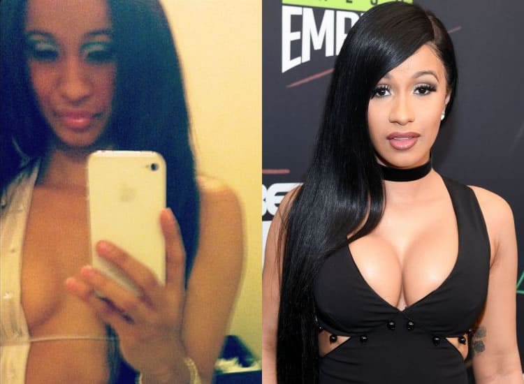 Cardi B boob job before and after photo