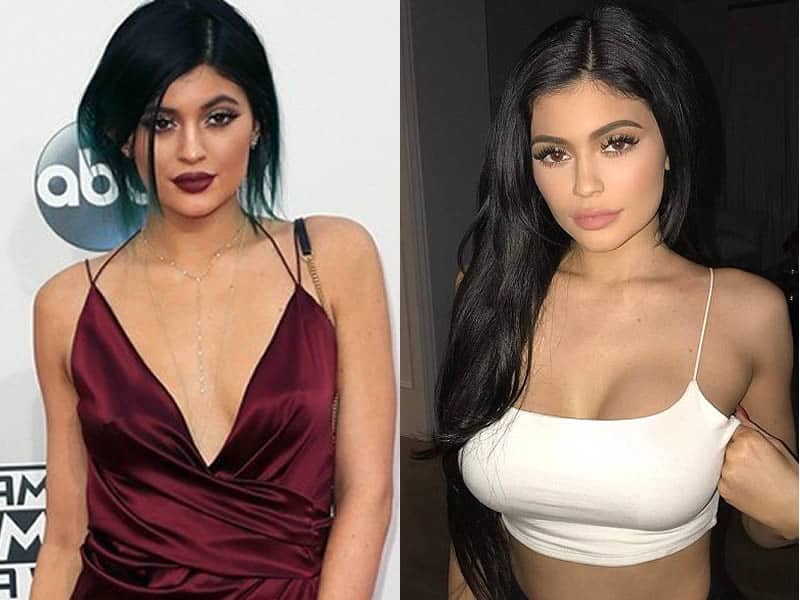 Did Kylie Jenner Have A Boob Job?