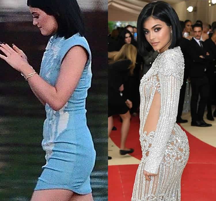 Does Kylie Jenner Have Butt Implants?