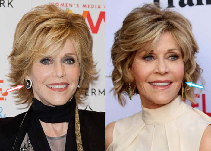 Has Jane Fonda Had Botox?