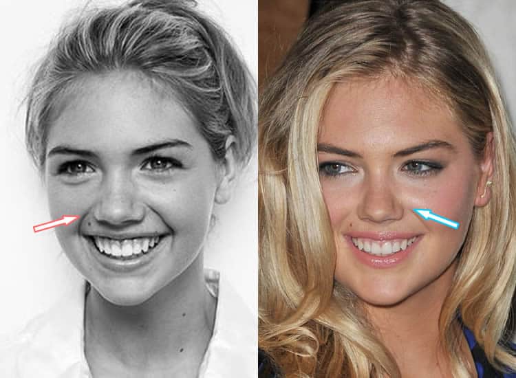Did Kate Upton Have A Nose Job?