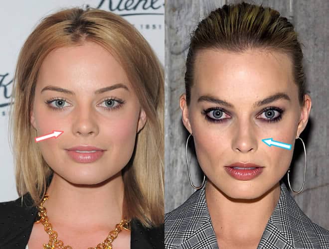 Did Margot Robbie have a nose job?