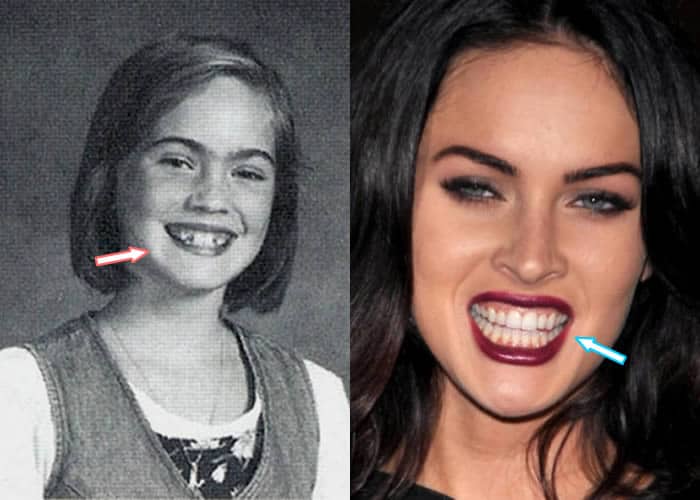 Megan Fox's Teeth