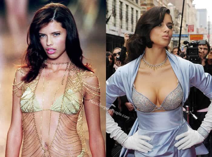 Has Adriana Lima Had Breast Implants?