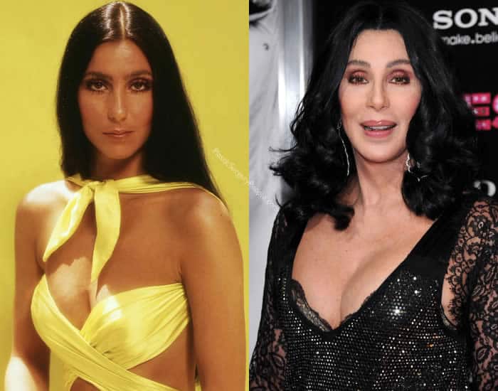 Does Cher Have Breast Implants?