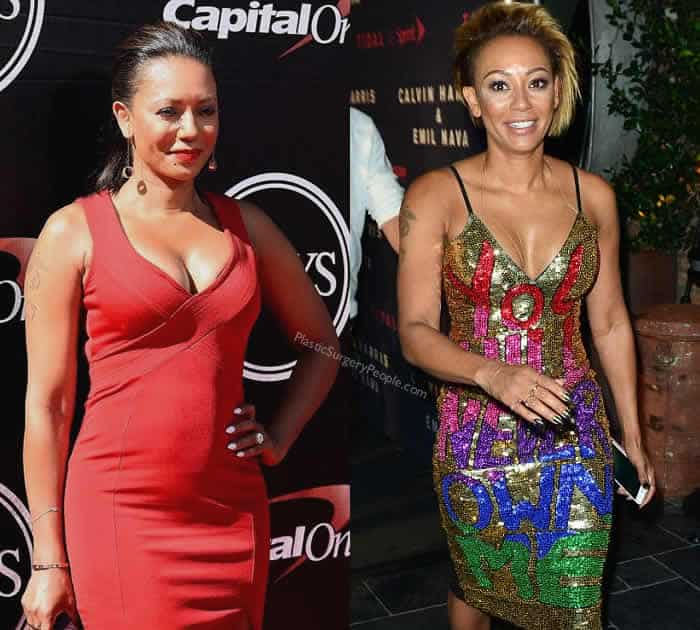 How did Mel B lose weight?