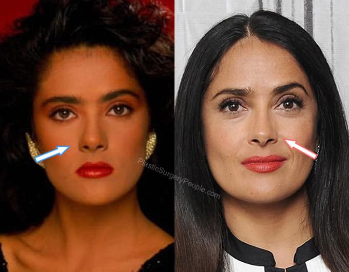 Salma Hayek nose job before and after