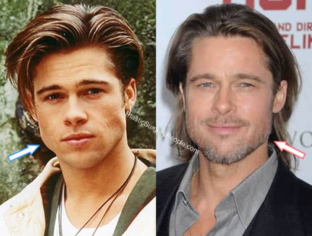 Brad Pitt jaw before and after