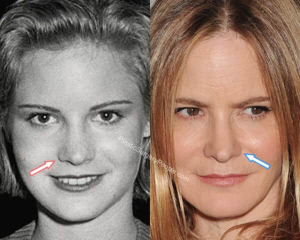 Jennifer Jason Leigh nose job before and after