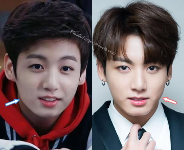 Jungkook face before and after
