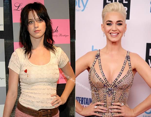 Katy Perry breast implants before and after