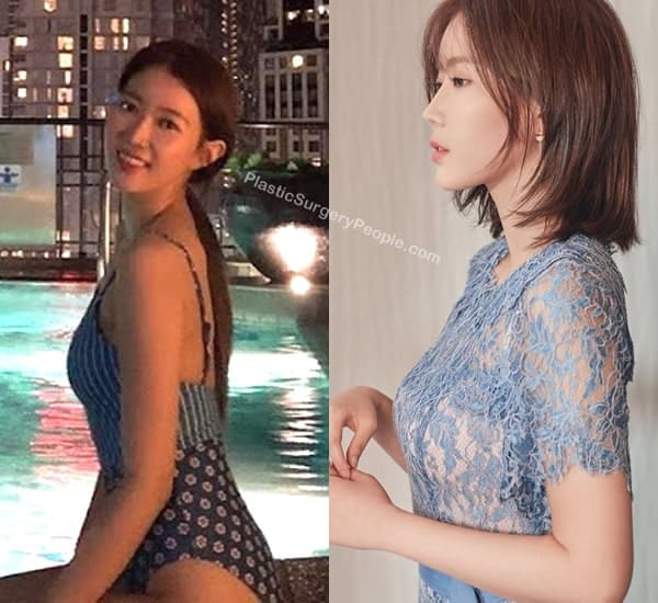 Has Im Soo Hyang had a boob job?