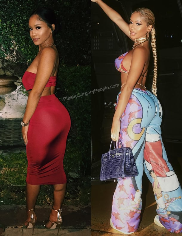 Saweetie butt implants before and after photo