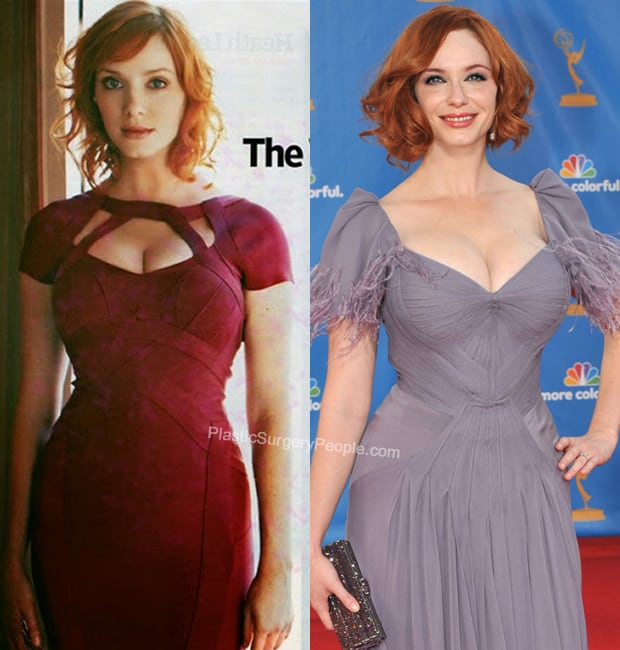 Christina Hendricks boob job before and after photo