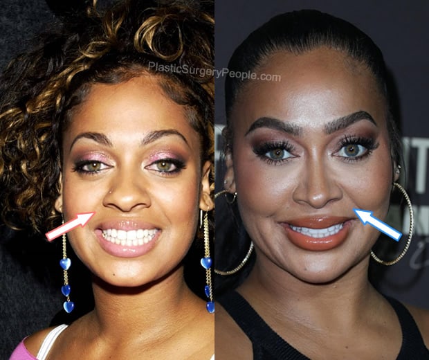 Lala Anthony nose job before and after photo