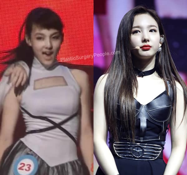 Nayeon boob job before and after photo