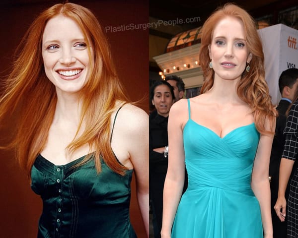 Jessica Chastain boob job before and after photo