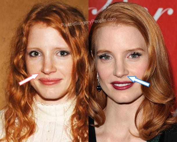 Jessica Chastain nose job before and after photo