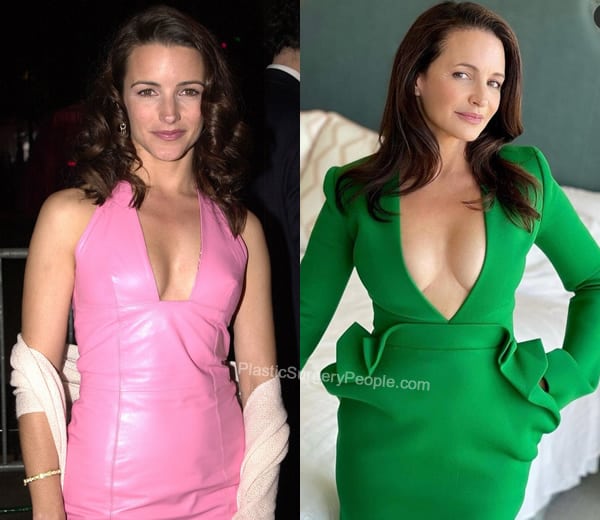 Kristin Davis boob job before and after photo