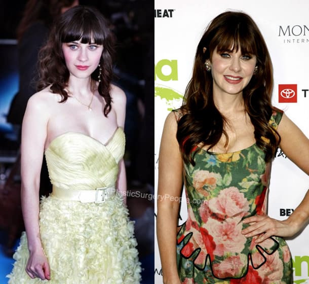 Zooey Deschanel boob job before and after photo