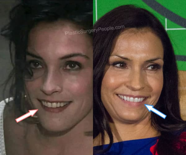 Famke Janssen teeth before and after photo comparison
